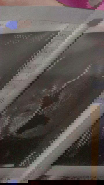 อยากรู้ว่าได้ลูกหญิงหรือชาย