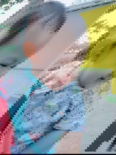 Hasil USG dan aslinya