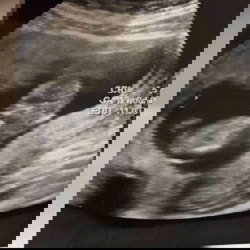 Bun tlg bgt ini apa ya di foto ush🙏🏼