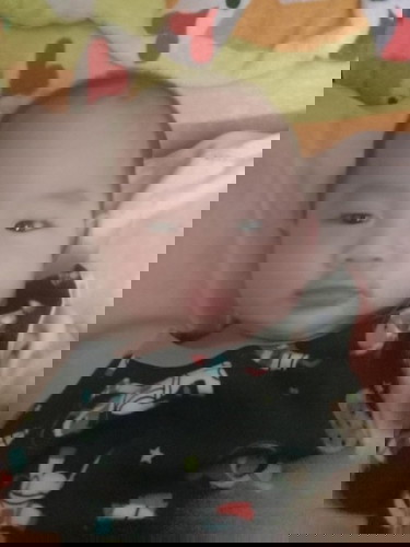 อาการผมร่วงหลังคลอดจะหายไปเมื่อไหร่ค่ะ มียาอะไรช่วยได้บ้าง ตอนนี้ลูก 4เดือน 5 วันแล้วค่ะ