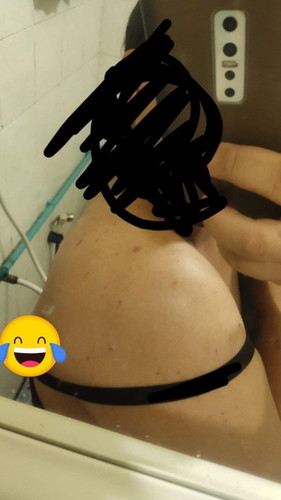 มีคุณเเม่ท่านไหนท้องใกล้คลอดเเล้วมีตุ่มขึ้นที่หลังหรือหน้าอกบ้างคะ บ้านนี้มีตุ่มตอนเข้า9เดือน🥺