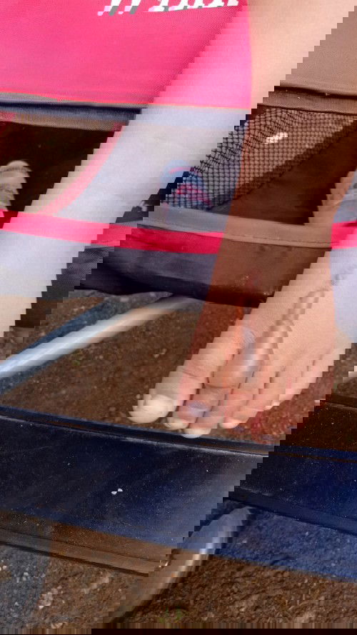 melepuh tersiram air panas