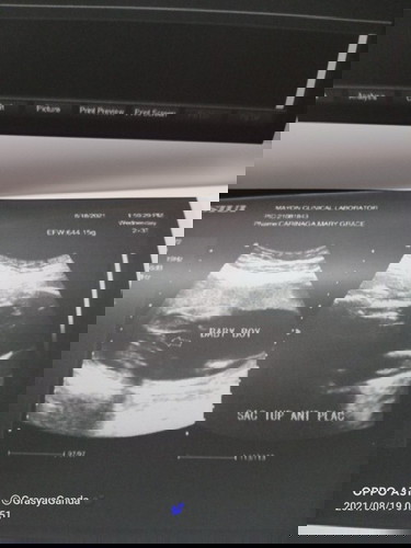 BABY GENDER