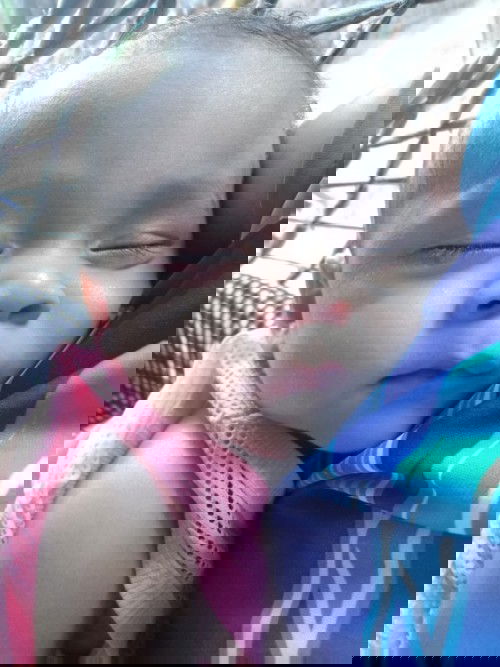 แพ้ผิวหนัง