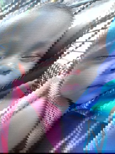 แพ้ผิวหนัง