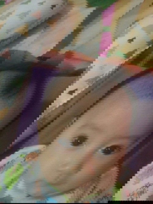 Bantu jawab dong bunda bundaku... Kepala anak sya kelihatan besar dan klihayan urat2 y gtu,