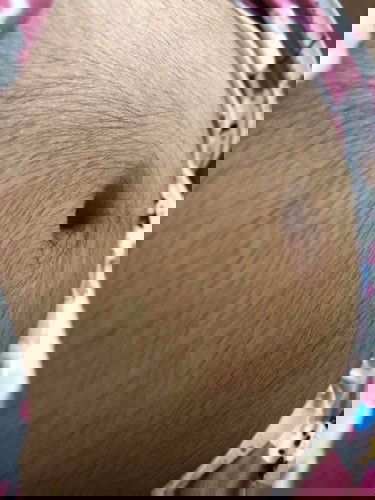 bat po kaya sobrang hairy ng tiyan ko?