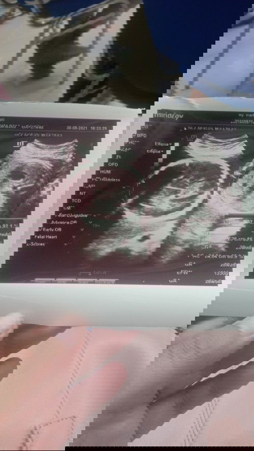 Tali ari ari di bawah