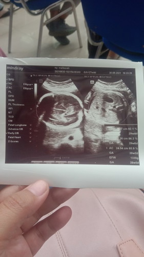 Tali ari ari di bawah