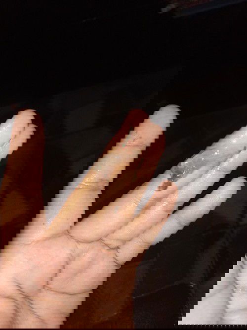 ปวดท้องคลอด