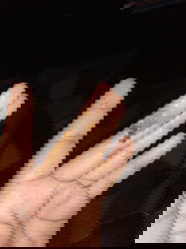 ปวดท้องคลอด