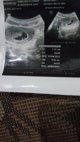 Bun da yg sma sperti sya gk,,skrg hamil 8mnggu dan wktu pipis ad ngeluarin dara