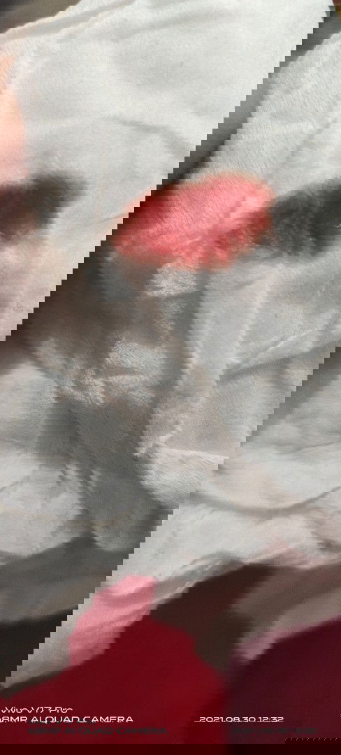 Keluar darah di kehamilan 7minggu