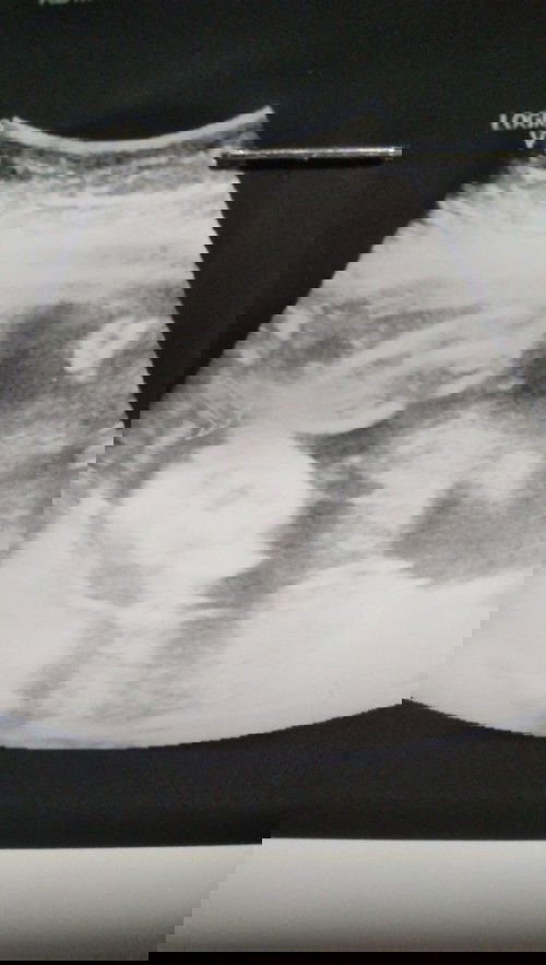 Anong gender ni baby?