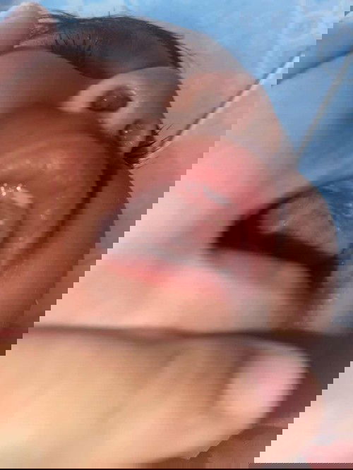 น้องได้11เดือนแม่พึ่งสังเกตเห็นตุ่มเหลืองๆที่เหงือกค่ะ