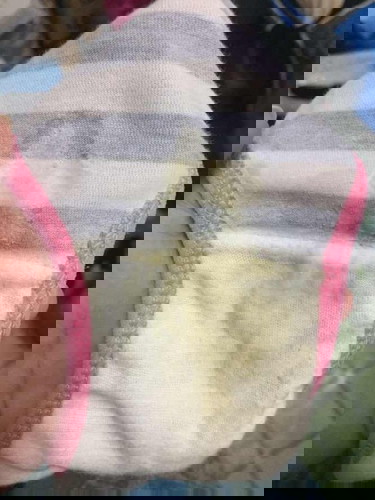 Yellowish discharge