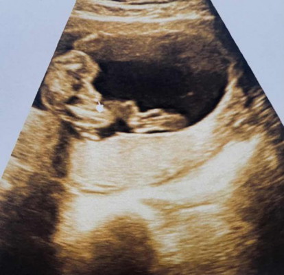 18 week 2 day