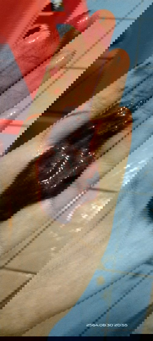 ต้องไปหาหมอมั้ย