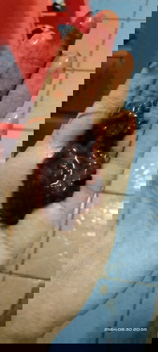 ต้องไปหาหมอมั้ย