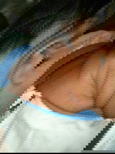 ผื่นแบบนี้ทำไงถึงหายคะแม่ๆเค้าเรียกว่าผื่นอะไรคะ