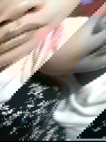 Butlig sa lips ni baby