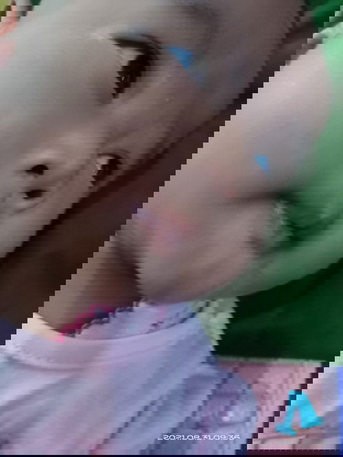 Pipi sama dagu kasar