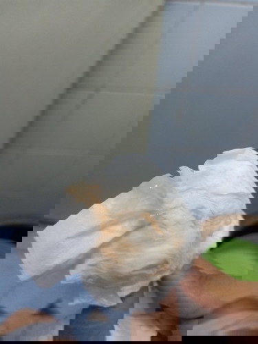 ตอนนี้ท้องได้15สัปดาห์