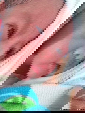 เจ็บปวดที่งดงาม