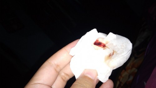 Keluar lendir campur darah