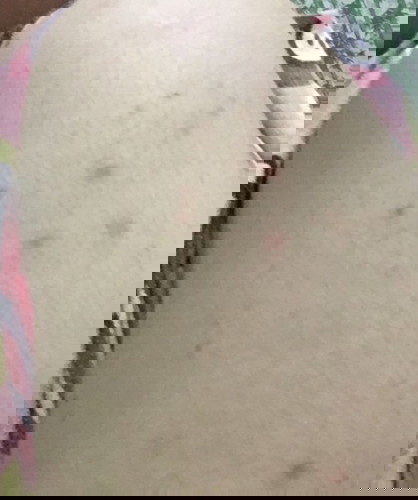 มีแม่ท้องคนไหนรับวัคซีนPZ มีตุ่มคันขึ้นไหมคะ
