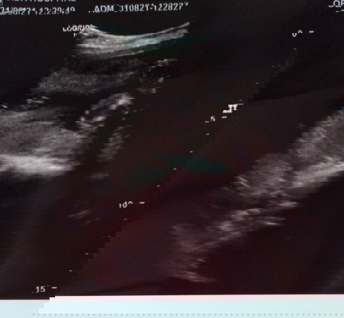 แม่ดูไม่ออก