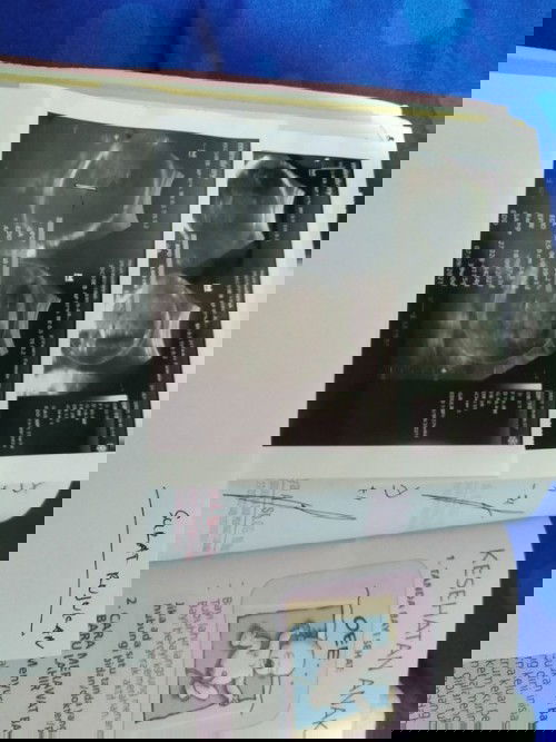 Janin belum masuk panggul usia 38W?