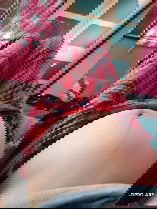 25สัปดาห์6วันท้องปั้นบ่อยมากและปวดฉี่บ่อยมากจะเป็นอะไรมั้ยค่ะไม่ค่อยดิ้นเลยค่ะ#ขอคำแนะนำหน่อยค่ะ