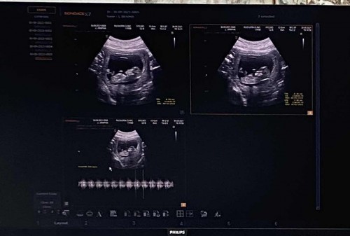 12+1 wแล้วตื่นเต้นมากกก 🦋