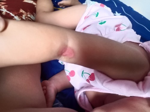 Ano po mabisang gamot dito?