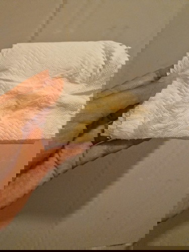 มีตกขาวออกมาสีน้ำตาลอ่อน เป็รอะไรไหมคะ สอบถามผู้รู้คะใครเคยเป็นแบบนี้ไหมคะ