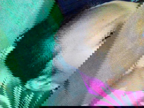 Rambut sangat rontok saat menyusui