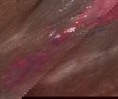 ขอโทษภาพอาจจะไม่สุภาพจ้า