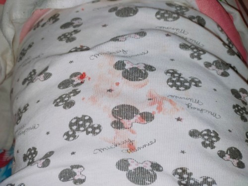 Sino po dito may case na katulad saken sana po matulungan nyo ko π nakakastress na po kasi