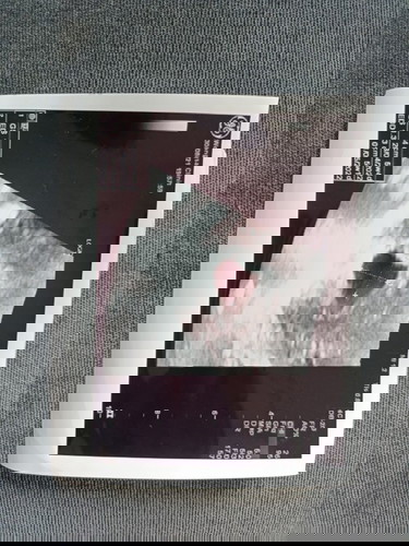 สอบถามแม่แม่ค่ะคุณแม่ท่านไหนเคยซาวตอน5วีคบ้างคะ เห็นตัวน้องกันบ้างไหมคะ