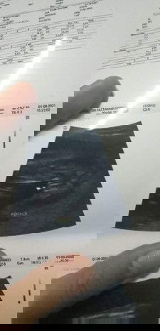 สรุปหมอบอกว่าผญค่ะ