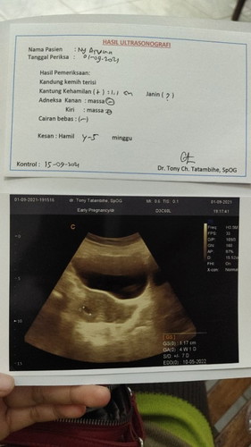 Usia kandungan 4-5minggu apakah sdh Ada janin?