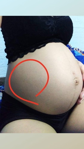 29week ลูกชอบดิ้นฝั่งขวา