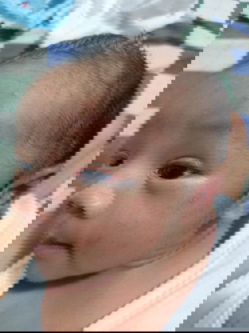 Mga mommy ano po gamot sa tumutubo sa face ni lo ko?