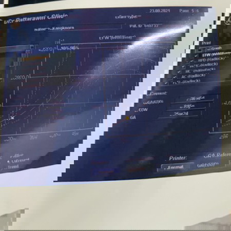 อยากรู้น้ำหนักตัว