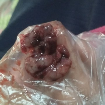 mohon di jawab. apa ada yang ngalamin keluar kayak gitu