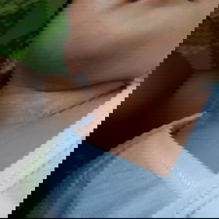 Ask ko lang po ano po gamot makawawala nyan? Salmat po