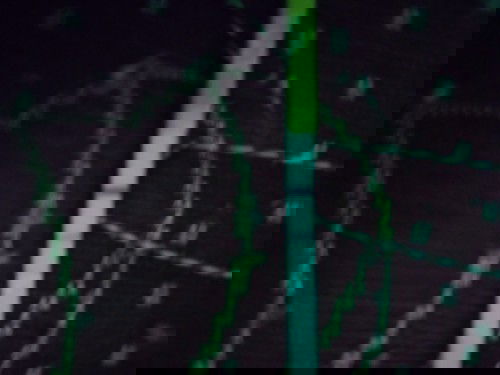 bund saya merasakan sakit di perut bagian kanan, kenpa ya bund ? 
mungkin ada yg merasakan sprti say