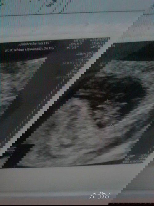 DJJ 165 usia kandungan 7 minggu