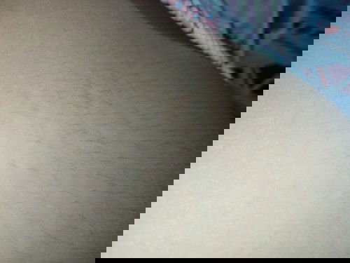 อันนี้ใช่รอยแตกรึป่าวคะ?